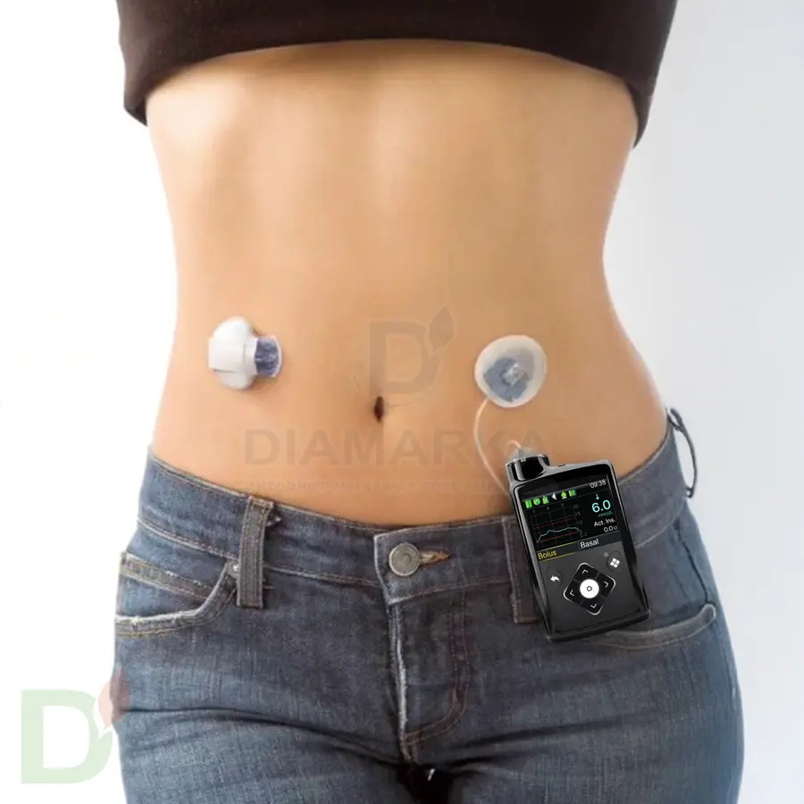 Инсулиновая помпа Medtronic MiniMed 740G MMT-1861 по программе обмена (Trade In)